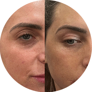 lydia-testimonial-before-after-avatar