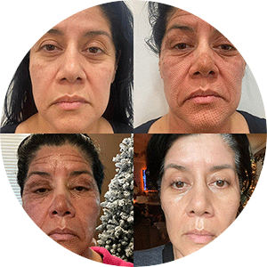 michelle-testimonial-before-after-avatar