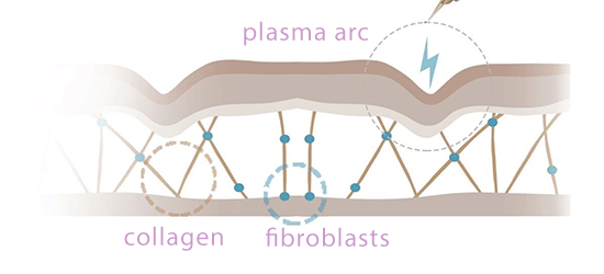 step-1-plasma-fibroblast-image