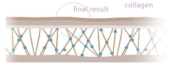 step-3-plasma-fibroblast.png-image